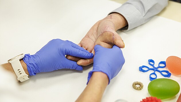 Osmatřicetiletého muže zasáhl elektrický proud, lékaři v Brně mu zachránili popálený palec i ruku. Vyhnul se tak amputaci. (19. listopadu 2025)