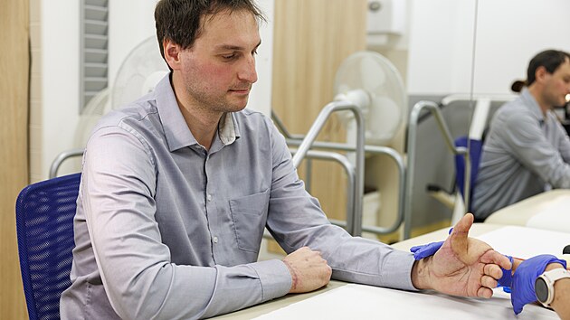 Osmatřicetiletého muže zasáhl elektrický proud, lékaři v Brně mu zachránili popálený palec i ruku. Vyhnul se tak amputaci. (19. listopadu 2025)