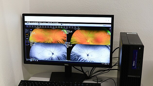 Nová oční klinika ve Vyškově je největším lékařským centrem pro dětské pacienty na Moravě.