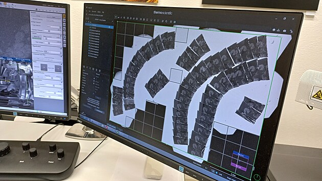 Vědci získali sérii asi tisícovky obrázků, kterou zpracovali prostřednictvím softwaru a mohli tak připravit digitální 3D model situace. Ten pomůže lépe pochopit, jak borelie reaguje s tkáněmi.