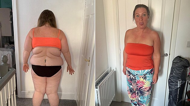 Žena zhubla díky injekcím na hubnutí. Už se dál nechtěla trápit s obezitou.