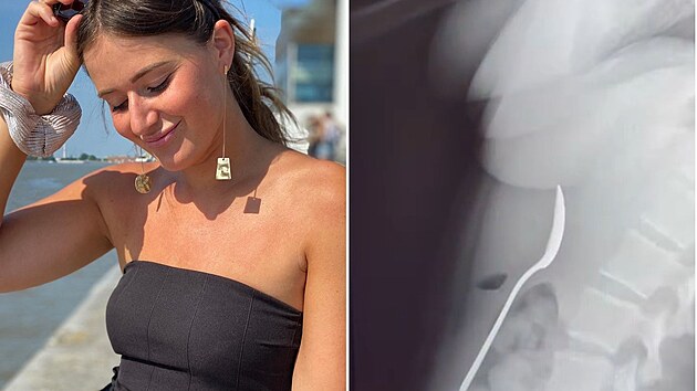 Bizarní nehoda mohla ženu stát život. Stáli při ní všichni svatí.