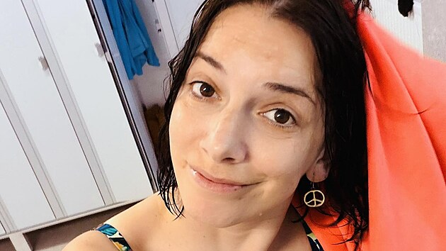 Dorota Nvotov&aacute; uk&aacute;zala foto v plavk&aacute;ch s protetickou podprsenkou a uměl&yacute;m prsem a otevřeně promluvila o strachu, studu i každodenn&iacute;ch situac&iacute;ch, kter&eacute; pro ni nejsou jednoduch&eacute;. (duben 2026)