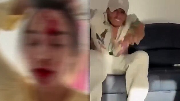 Kr&aacute;lovna kr&aacute;sy tvrd&iacute;, že ji v Cannes napadl stylista. Incident vy&scaron;etřuje policie
