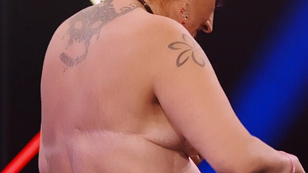 Kamila uk&aacute;zala v Naked Attraction sv&eacute; jizvy.