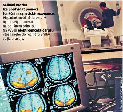 Selhání mozku lze pedvídat pomocí funkní magnetické rezonance.