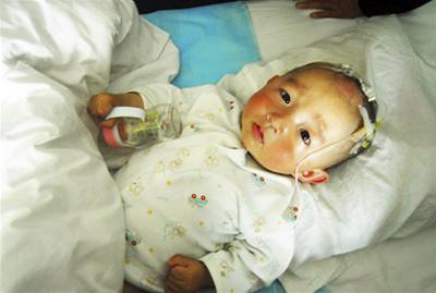 Mezi dtmi, které onemocnly po pití kontaminovaného mléka, je i toto novorozen.