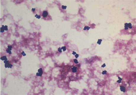 bakterie Staphylococus epidermidis