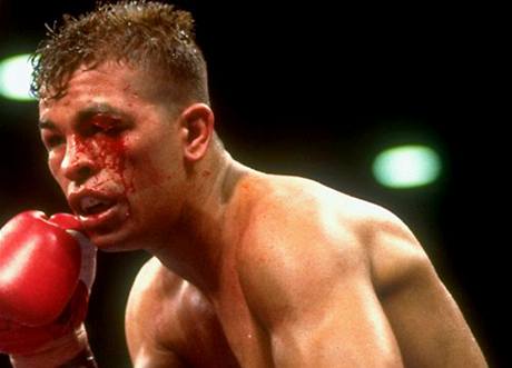 Arturo Gatti.