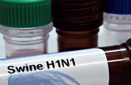 Zkumavka s virem A(H1N1).