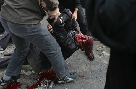Írántí demonstranti odnáejí tlo mue zasteleného pi stetech s poádkovými silami.