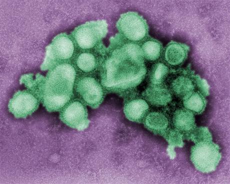 Virus H1N1 pod mikroskopem.