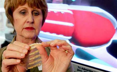 Jihoafrická lékaka Sonnet Ehlersová vymyslela tzv. zubatý kondom, který má ochránit eny ped znásilnním.