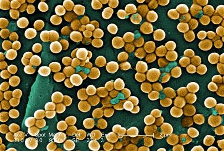 Zlatý stafylokok (Staphylococcus aureus)