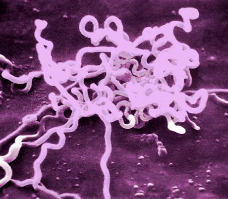 Bakterie Treponema Pallidum, která zpsobuje Syfilis.