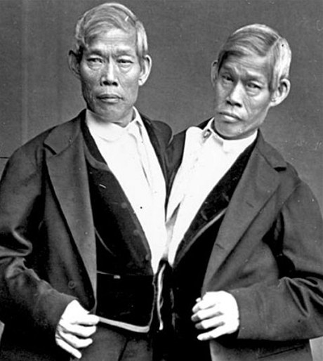 Slavná siamská dvojata se narodila v roce 1811.