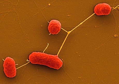 EHEC bakterie, která zpsobuje krvácivé prjmy
