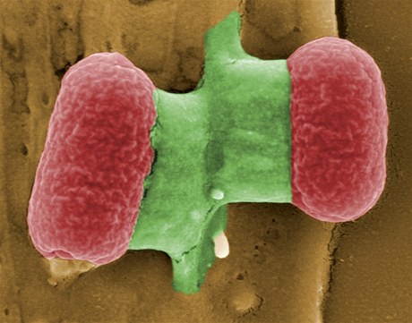 EHEC bakterie, kter zpsobuje krvciv prjmy