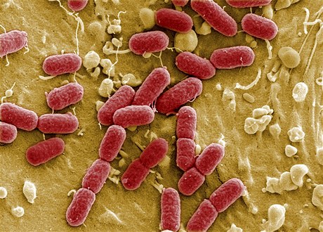 Bakterie EHEC 