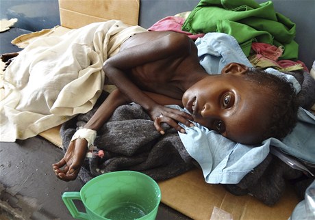 Hladovjící dít v Somálsku
