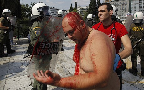 Podle agentury AP utrpli tyi lidé zranní, z toho dva policisté a dva demonstranti. 