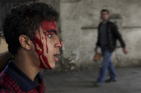 Zranný egyptský demonstrant