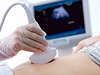 Vyeten ultrazvukem - ilustran foto.