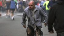 Popálený James Costello (15. 4. 2013) | na serveru Lidovky.cz | aktuální zprávy