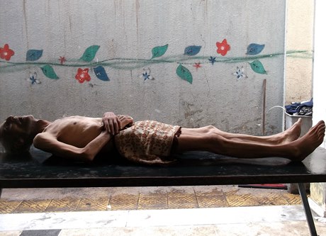 V Sýrii rozvrácené válkou umírají lidé hlady. Na snímku zesnulý Avad Saidí, obyvatel obléhaného damaského tábora Jarmúk. 