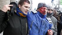 Jeden ze zraněných demonstrantů. | na serveru Lidovky.cz | aktuální zprávy
