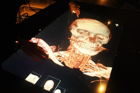 védským lékam je k dispozici i virtuální pitevní stl, domácí vynález. Data z CT sken lze vizualizovat a dotykem ruky ovládat jako obí iPad nebo iPhone.