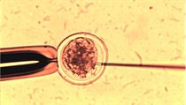 Živé vědy v Brně mají oživit český výzkum, na snímku biopsie embryonálních buněk. Živé vědy v Brně mají oživit český výzkum, na snímku biopsie embryonálních buněk.