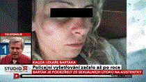 Dr Jaroslav Barták (inset) claims that his former assistant Lucie, who is recovering from an alleged beating, was hired to provide him with sexual services Dr Jaroslav Barták (inset) claims that his former assistant Lucie, who is recovering from an alleged beating, was hired to provide him with sexual services