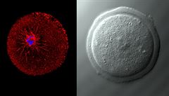 Snímek z konfokálního mikroskopu: modře je nabarvena DNA a červeně protein Tubulin. Jde o oocyt ve stadiu meiotického zrání (ilustrační foto). Snímek z konfokálního mikroskopu: modře je nabarvena DNA a červeně protein Tubulin. Jde o oocyt ve stadiu meiotického zrání (ilustrační foto).