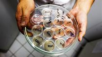 Vedle soukromých subjektů v ČR funguje pod Ústavem hematologie a krevní... | na serveru Lidovky.cz | aktuální zprávy