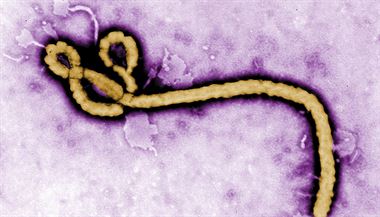Charakteristick tvar viru ebola.