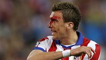 Mario Mandžukič z Atlétika ukazuje zranění, ke kterému přišel při utkání z... | na serveru Lidovky.cz | aktuální zprávy