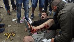 Zranný migrant leí na zemi po stetech s makedonskými policisty.
