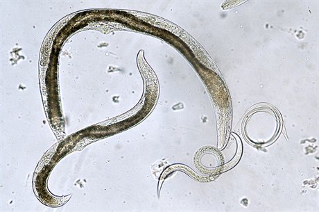 Parazit (ilustraní foto)
