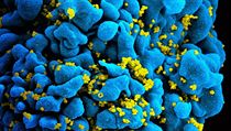T-lymfocyt napadený virem HIV. | na serveru Lidovky.cz | aktuální zprávy