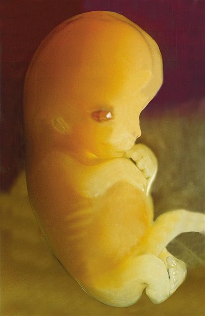 Embryo.