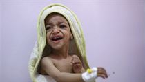 Podvyiven chlapec ple na jednotce intenzivn pe v nemocnici v San.