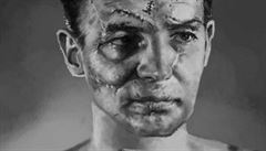 Terry Sawchuk. Na upravené fotografii jsou zvýraznné stehy  tch ml na...