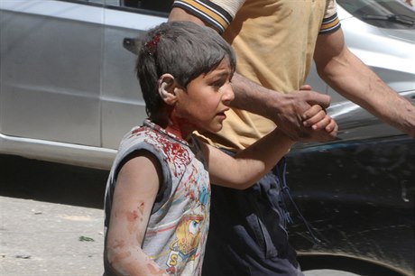 Bombardování Aleppa: zranný chlapec.