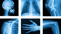 Švédská vláda poukazovala na fakt, že diagnostické metody jako například... | na serveru Lidovky.cz | aktuální zprávy