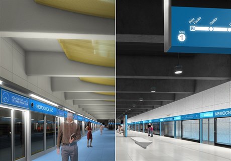 Porovnání pvodního (vlevo) a aktuálního návrhu stanice Nemocnice Kr.