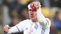 Zraněný chorvatský hráč Dinama Kyjev Domagoj Vida. | na serveru Lidovky.cz | aktuální zprávy