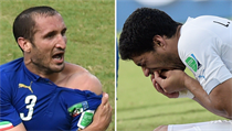 Nejzvláštnější moment světového šampionátu 2014. Uruguayec Suárez právě „kousl“... | na serveru Lidovky.cz | aktuální zprávy