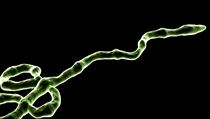 Virus ebola. | na serveru Lidovky.cz | aktuální zprávy