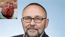 Poslance a šéfa regionální odbočky Alternativy pro Německo (AfD) v Brémách... | na serveru Lidovky.cz | aktuální zprávy